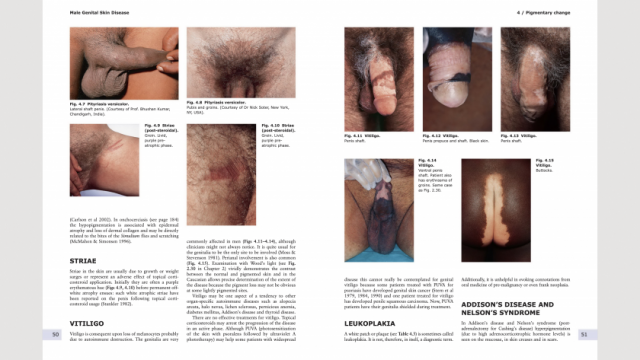 Male genital Skin Disease pages 50-51